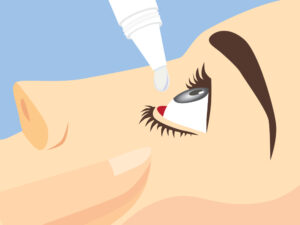 יובש בעיניים - תסמינים, סיבוכים ודרכי טיפול